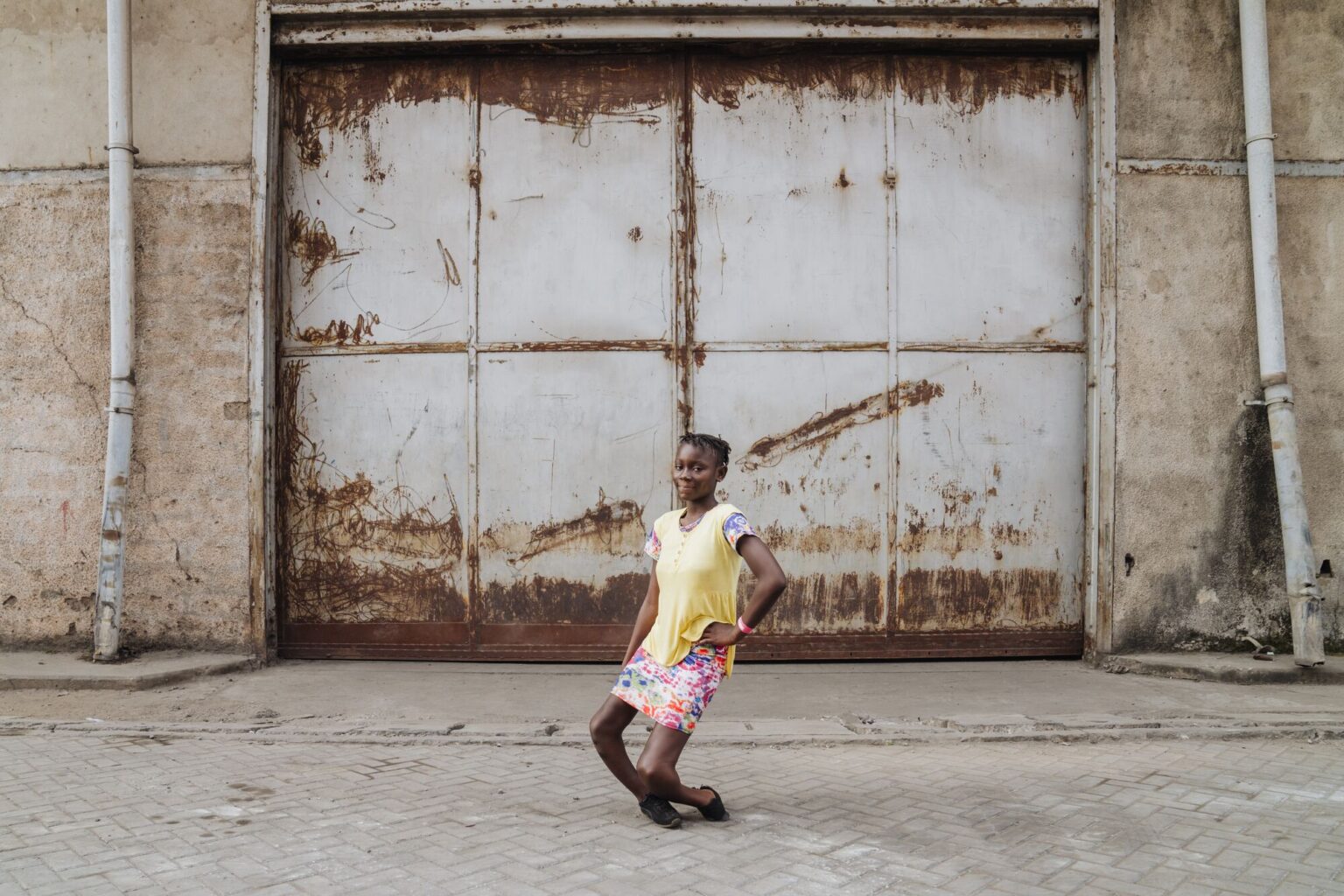 Ruth, patiente orthopédique atteinte de la maladie de Blount, avant son opération prise en charge par Mercy Ships