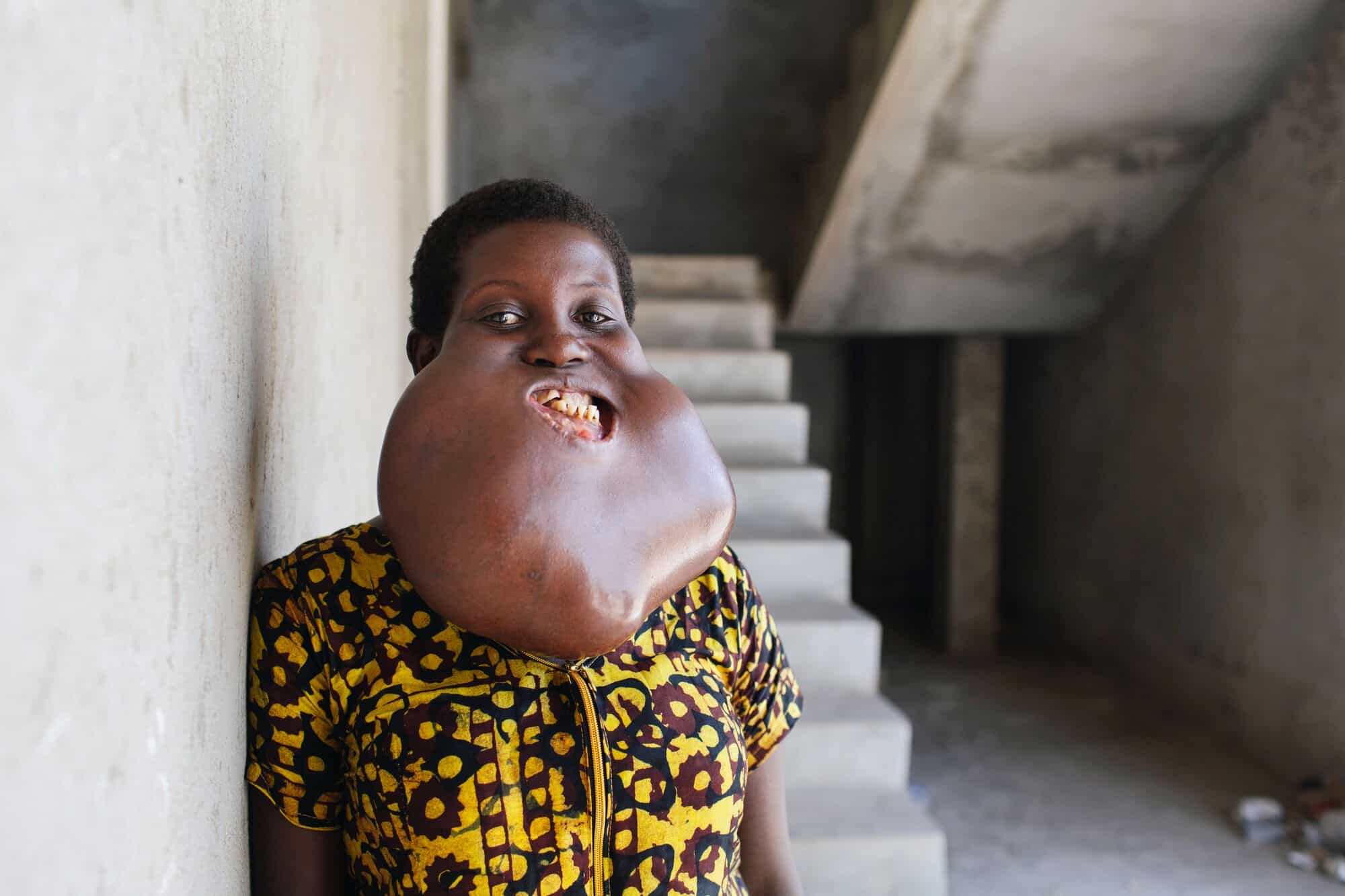 Charity before surgery